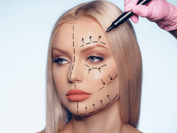 Face lift