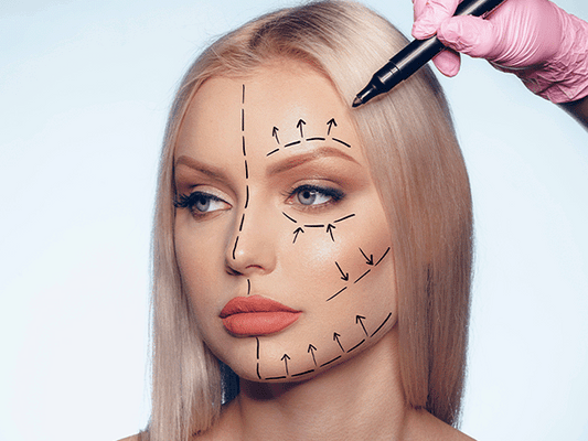 Face lift