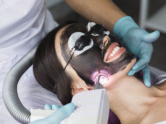 Carbon peel